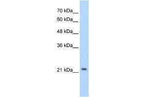 WB Suggested Anti-DLX2 Antibody Titration:  2. (DLX2 antibody  (C-Term))