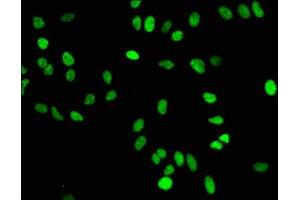 Immunofluorescence staining of Hela cells with ABIN7127305 at 1:50,counter-stained with DAPI. (Recombinant HIST1H4A antibody  (meLys16))