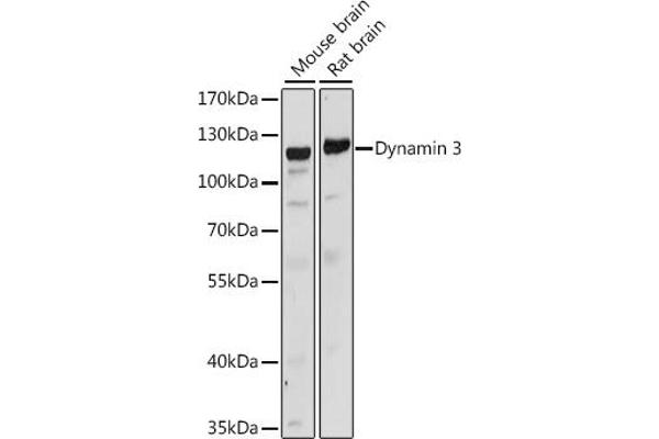 Dynamin 3 抗体  (AA 410-555)