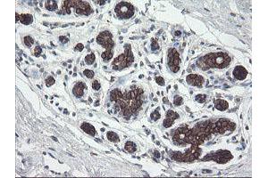 Immunohistochemical staining of paraffin-embedded Human breast tissue using anti-DPH2 mouse monoclonal antibody. (DPH2 antibody)
