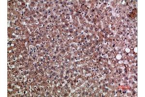 Immunohistochemical analysis of paraffin-embedded human-liver, antibody was diluted at 1:200 (CXCL12 antibody  (AA 31-80))