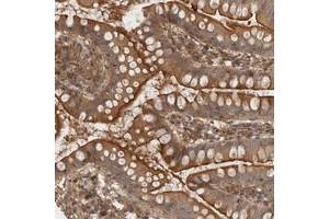 Immunohistochemical staining of human small intestine with PPP1R42 polyclonal antibody  shows distinct cytoplasmic positivity in glandular cells.