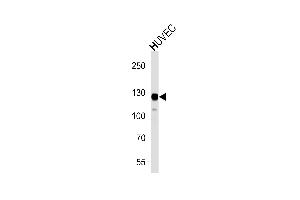 Western blot analysis of lysate from HUVEC cell line,using PTK2 Antibody (N-term) (ABIN1882052 and ABIN2843641). (FAK antibody  (N-Term))