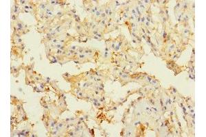 Immunohistochemistry of paraffin-embedded human lung tissue using ABIN7148571 at dilution of 1:100 (CIR1 antibody  (AA 1-160))