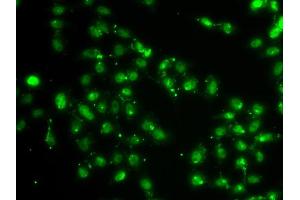 Immunofluorescence analysis of A549 cells using L3MBTL1 antibody. (L3MBTL1 antibody)