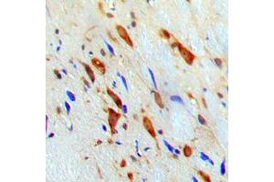 Immunohistochemical analysis of STAT1 staining in human brain formalin fixed paraffin embedded tissue section. (STAT1 antibody  (Center))