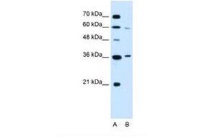 Image no. 2 for anti-Presenilin Associated, Rhomboid-Like (PARL) (AA 97-146) antibody (ABIN6738135)