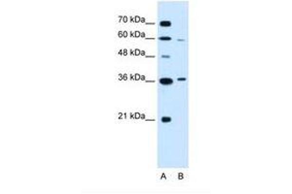 PARL 抗体  (AA 97-146)