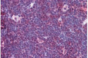 Human Thymus: Formalin-Fixed, Paraffin-Embedded (FFPE) (NLRP13 antibody  (N-Term))