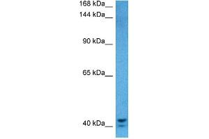 Host:  Rabbit  Target Name:  KIAA0100  Sample Tissue:  Human 293T Whole Cell lysates  Antibody Dilution:  1ug/ml (KIAA0100/BCOX1 antibody  (Middle Region))