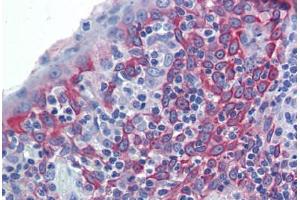 Human Tonsil (formalin-fixed, paraffin-embedded) stained with LIN7C antibody ABIN462236 followed by biotinylated goat anti-rabbit IgG secondary antibody ABIN481713, alkaline phosphatase-streptavidin and chromogen. (LIN7C antibody  (N-Term))