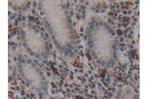 Immunohistochemistry (IHC) image for anti-Coagulation Factor XIII, A1 Polypeptide (F13A1) (AA 107-345) antibody (ABIN7433159)