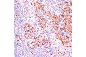 Immunohistochemistry of paraffin-embedded mouse spleen using MZB1 antibody (ABIN7268403) at dilution of 1:100 (40x lens). (MZB1 antibody  (AA 1-189))