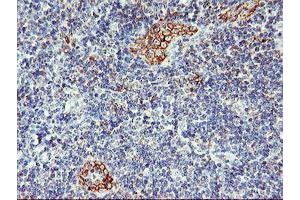 Immunohistochemistry (IHC) image for anti-ArfGAP with GTPase Domain, Ankyrin Repeat and PH Domain 1 (AGAP1) antibody (ABIN1497475) (AGAP1 antibody)