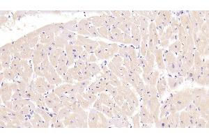 Detection of TNNT2 in Porcine Cardiac Muscle Tissue using Monoclonal Antibody to Troponin T Type 2, Cardiac (TNNT2) (Cardiac Troponin T2 antibody  (AA 2-100))