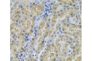 Immunohistochemistry of paraffin-embedded Mouse kidney using SERPINA6 Polyclonal Antibody at dilution of 1:100 (40x lens). (SERPINA6 antibody)