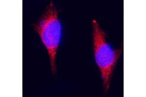 IF analysis of ZAC/Plagl1 using anti-ZAC/Plagl1 antibody (ABIN7599464). (PLAGL1 antibody  (AA 1-527))