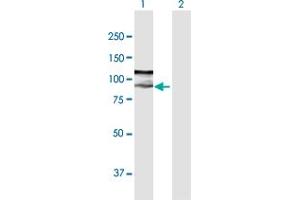 Western Blot analysis of ZFYVE9 expression in transfected 293T cell line by ZFYVE9 MaxPab polyclonal antibody. (ZFYVE9 antibody  (AA 1-762))