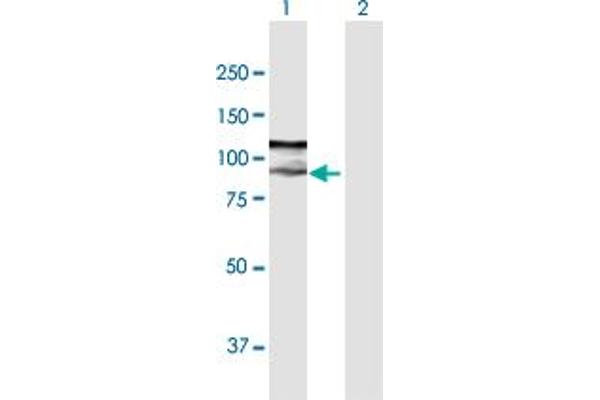 ZFYVE9 Antikörper  (AA 1-762)
