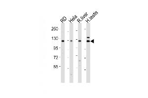 Western Blotting (WB) image for anti-Vinculin (VCL) (AA 12-39), (N-Term) antibody (ABIN391625)