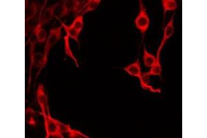 ABIN6277899 staining HeLa by IF/ICC. (Amylin/DAP antibody  (Internal Region))
