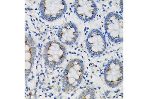 Immunohistochemistry of paraffin-embedded Human colon using SDF4 Rabbit pAb (ABIN7270606) at dilution of 1:100 (40x lens).