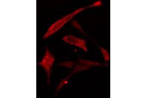 ABIN6274778 staining A549 cells by IF/ICC. (RPL30 antibody  (C-Term))