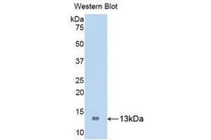 Western Blotting (WB) image for anti-S100 Calcium Binding Protein A8 (S100A8) (AA 1-93) antibody (ABIN1078510) (S100A8 antibody  (AA 1-93))