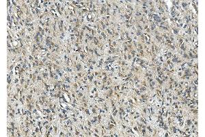 IHC analysis of SYP using anti-SYP antibody (ABIN7603120).