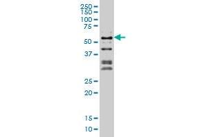 NFIC monoclonal antibody (M03A), clone 1D6 Western Blot analysis of NFIC expression in Hela S3 NE . (NFIC antibody  (AA 314-423))