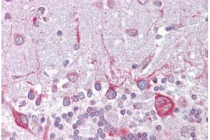 Anti-PSEN1 / Presenilin 1 antibody IHC staining of human brain, cerebellum. (Presenilin 1 antibody  (AA 107-156))