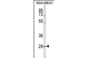 YIPF5 antibody  (N-Term)