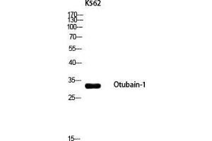 Western Blot (WB) analysis of K562 using Otubain-1 antibody.