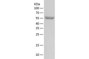 Western Blotting (WB) image for Protein Phosphatase, Mg2+/Mn2+ Dependent, 1G (PPM1G) (AA 1-546) protein (His tag) (ABIN7284374) (PPM1G Protein (AA 1-546) (His tag))