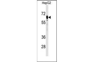 Image no. 1 for anti-phosphoenolpyruvate Carboxykinase 2 (Mitochondrial) (PEPCK) (N-Term) antibody (ABIN360567)