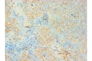 Immunohistochemistry of paraffin-embedded human tonsil tissue using ABIN7159650 at dilution of 1: 100