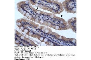 Human Intestine (SMPDL3B antibody  (N-Term))