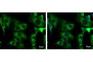ICC/IF Image ACADM antibody detects ACADM protein at mitochondria by immunofluorescent analysis.