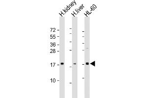 All lanes : Anti-FHIT Antibody (N-Term) at 1:2000 dilution Lane 1: human kidney lysate Lane 2: human liver lysate Lane 3: HL-60 whole cell lysate Lysates/proteins at 20 μg per lane. (FHIT antibody  (AA 19-54))