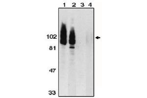 Image no. 1 for anti-ADAM Metallopeptidase Domain 17 (ADAM17) (AA 807-823), (C-Term) antibody (ABIN264994) (ADAM17 antibody  (C-Term))