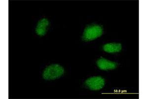 Immunofluorescence of purified MaxPab antibody to PPIL4 on HeLa cell.