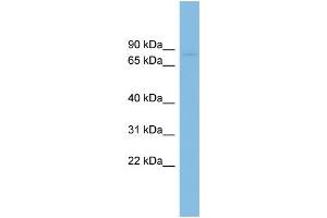 WB Suggested Anti-RAI16 Antibody Titration: 0. (FAM160B2 antibody  (N-Term))