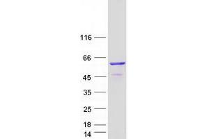 TBCE Protein (Transcript Variant 1) (Myc-DYKDDDDK Tag)