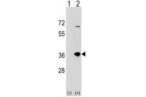 Western blot analysis of SULT1B1 (arrow) using rabbit polyclonal SULT1B1 Antibody (C-term) . (SULT1B1 antibody  (C-Term))