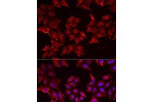 Immunofluorescence analysis of MCF7 cells using PCBD1 Polyclonal Antibody (PCBD1 antibody)