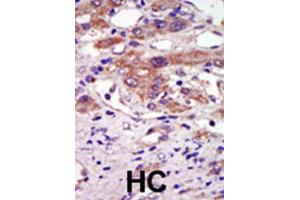 Immunohistochemistry (IHC) image for anti-Ribosomal Protein S6 Kinase, 90kDa, Polypeptide 6 (RPS6KA6) antibody (ABIN3003591) (RPS6KA6 antibody)