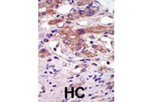 Immunohistochemistry (IHC) image for anti-Ribosomal Protein S6 Kinase, 90kDa, Polypeptide 6 (RPS6KA6) antibody (ABIN3003591) (RPS6KA6 antibody)