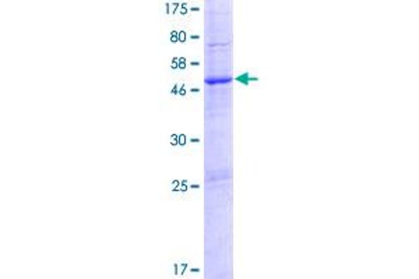 PTCHD1 Protein (AA 1-256) (GST tag)