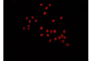 ABIN6272529 staining Hela by IF/ICC. (LARP1B antibody  (Internal Region))
