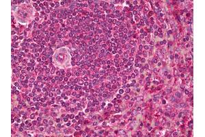 Anti-PCSK9 antibody IHC of human spleen. (PCSK9 antibody)